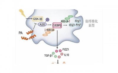 ​怎么理解创新思维和抽象思维 抽象和具体属于创新思维活动