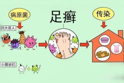 ​灰指甲症状是什么 原因是这样