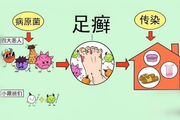 灰指甲症状是什么 原因是这样 灰指甲症状是什么 原因是这样