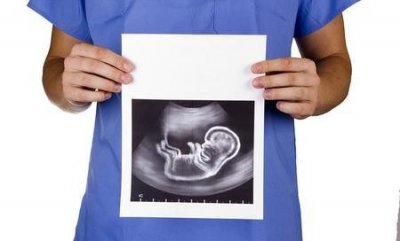 ​为什么会出现胎停育现象的(停育有什么症状)