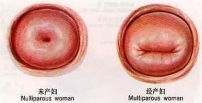 ​女人下面松弛什么症状（如何判断是否阴道松弛）