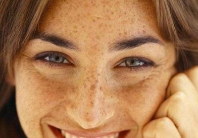 ​怎样去除雀斑最有效(脸上的雀斑怎么去除最有效)