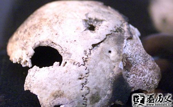 希特勒头骨