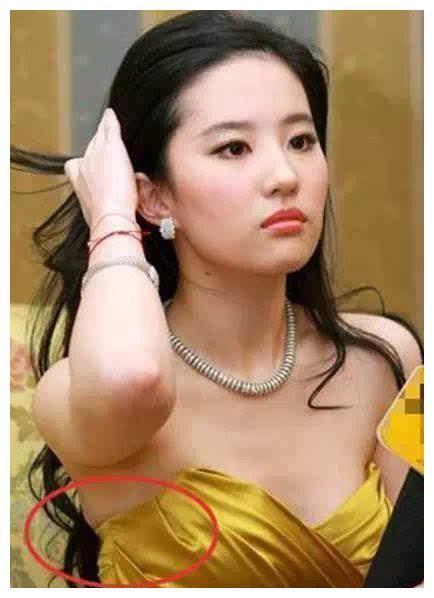 只因刘亦菲做过变性手术，宋承宪要和她分手？