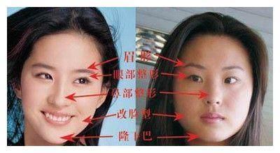 只因刘亦菲做过变性手术，宋承宪要和她分手？