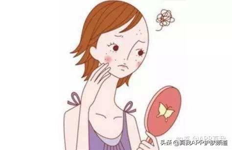 去痘印好用的产品推荐（亲测四款淡化痘印好物）(2)